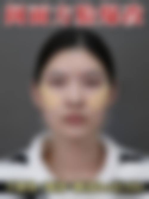 上海吴月兰整形美容诊所擅长项目。